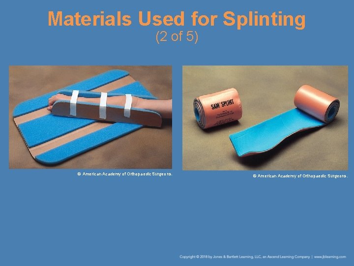 Materials Used for Splinting (2 of 5) © American Academy of Orthopaedic Surgeons. 
