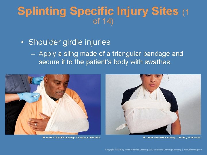 Splinting Specific Injury Sites (1 of 14) • Shoulder girdle injuries – Apply a