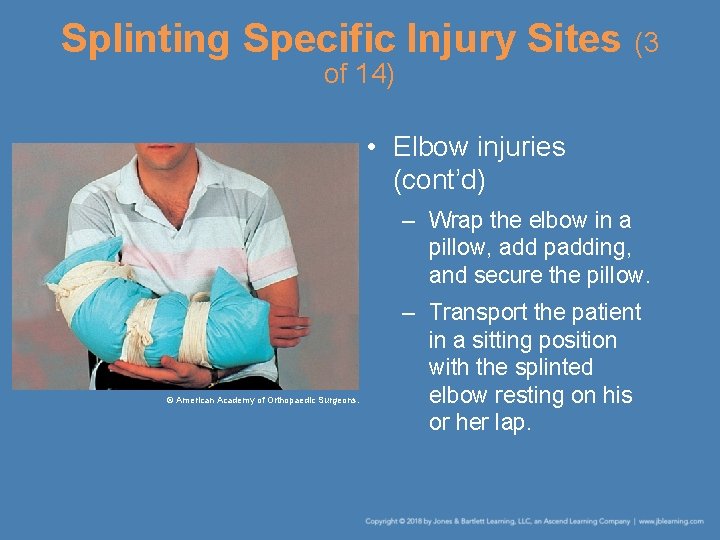 Splinting Specific Injury Sites (3 of 14) • Elbow injuries (cont’d) – Wrap the