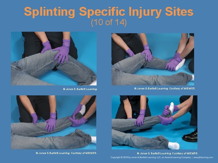 Splinting Specific Injury Sites (10 of 14) © Jones & Bartlett Learning. Courtesy of