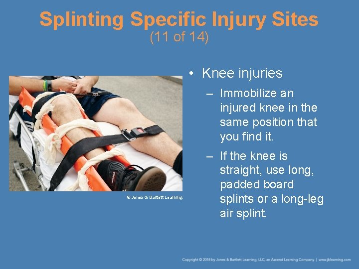 Splinting Specific Injury Sites (11 of 14) • Knee injuries – Immobilize an injured