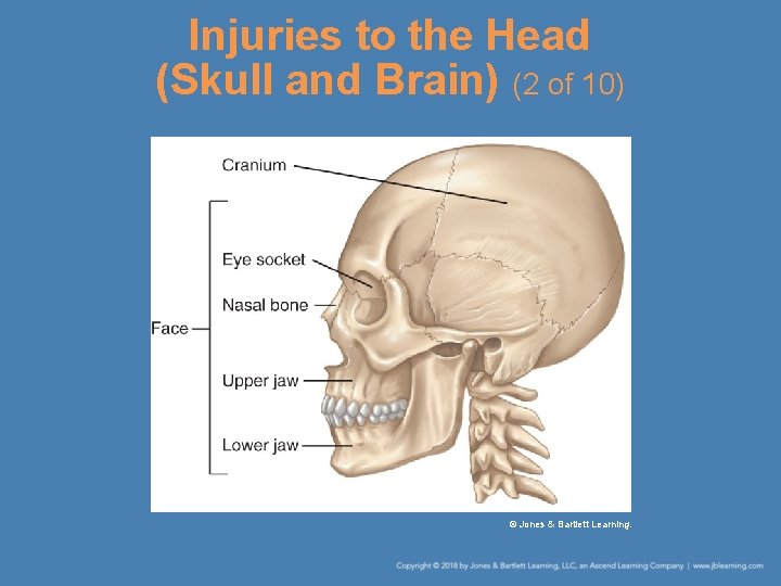 Injuries to the Head (Skull and Brain) (2 of 10) © Jones & Bartlett