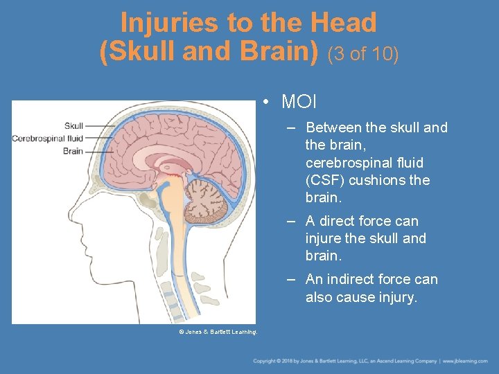 Injuries to the Head (Skull and Brain) (3 of 10) • MOI – Between