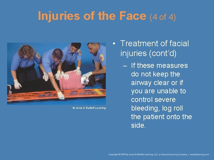 Injuries of the Face (4 of 4) • Treatment of facial injuries (cont’d) ©