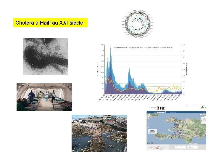 Cholera à Haiti au XXI siècle 