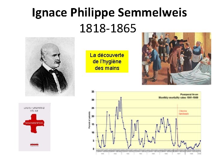  Ignace Philippe Semmelweis 1818 -1865 La découverte de l’hygiène des mains 
