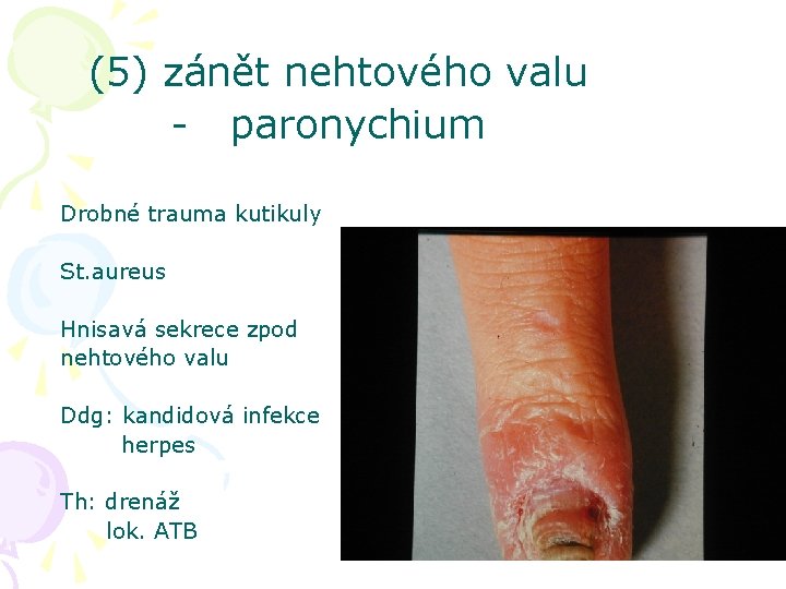 (5) zánět nehtového valu - paronychium Drobné trauma kutikuly St. aureus Hnisavá sekrece zpod