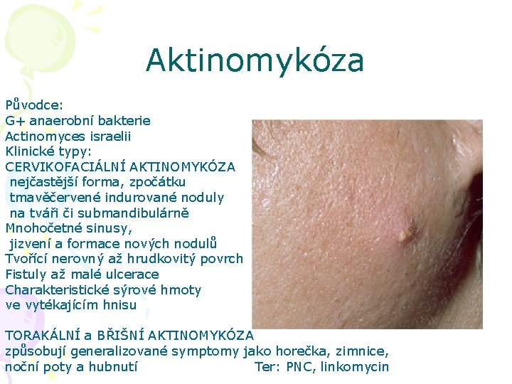 Aktinomykóza Původce: G+ anaerobní bakterie Actinomyces israelii Klinické typy: CERVIKOFACIÁLNÍ AKTINOMYKÓZA nejčastější forma, zpočátku