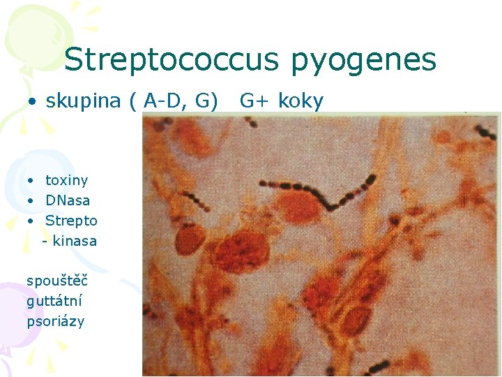 Streptococcus pyogenes • skupina ( A-D, G) • toxiny • DNasa • Strepto -