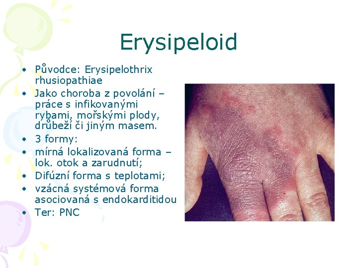 Erysipeloid • Původce: Erysipelothrix rhusiopathiae • Jako choroba z povolání – práce s infikovanými