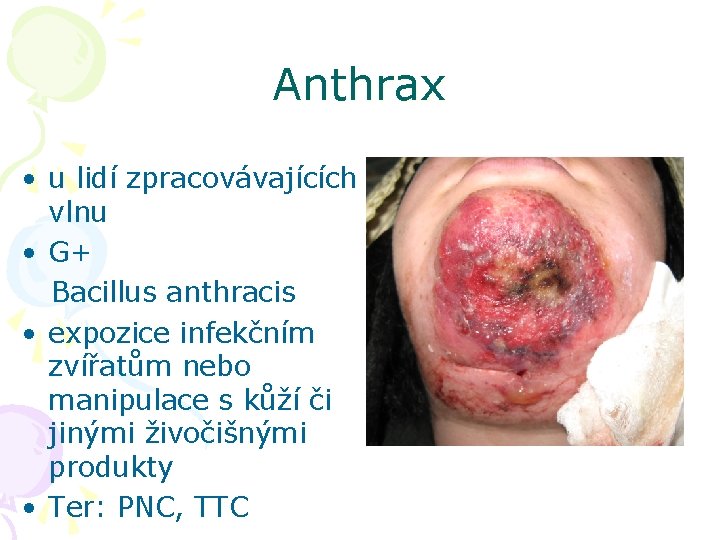 Anthrax • u lidí zpracovávajících vlnu • G+ Bacillus anthracis • expozice infekčním zvířatům