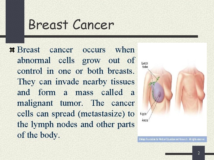 Breast Cancer Breast cancer occurs when abnormal cells grow out of control in one
