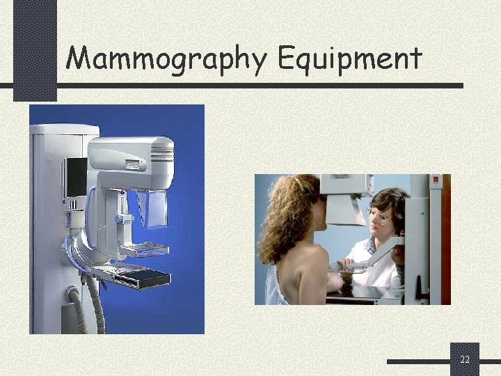 Mammography Equipment 22 