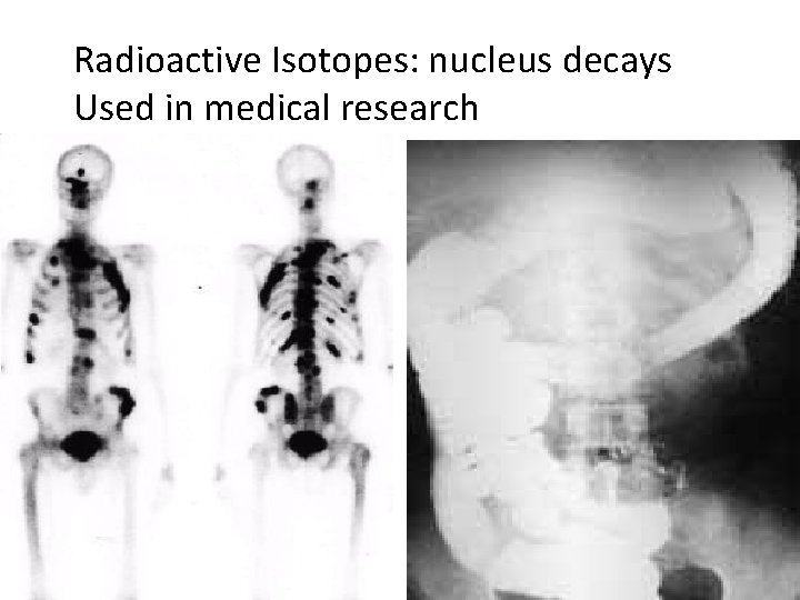 Radioactive Isotopes: nucleus decays Used in medical research 