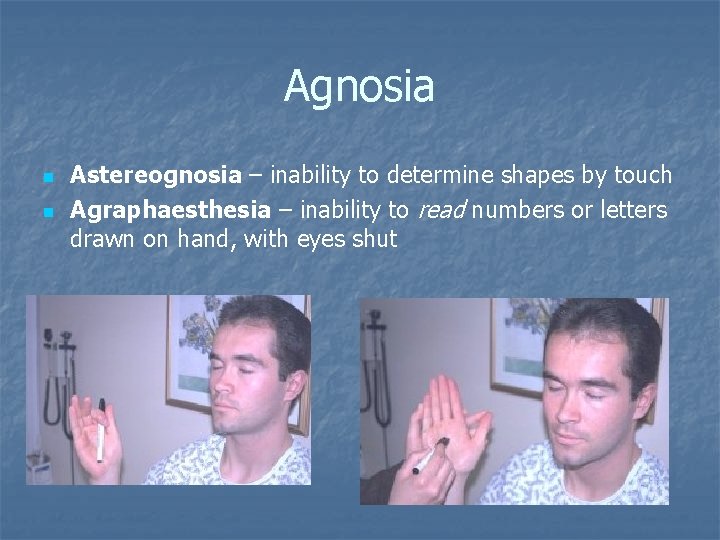 Agnosia n n Astereognosia – inability to determine shapes by touch Agraphaesthesia – inability