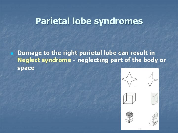 Parietal lobe syndromes n Damage to the right parietal lobe can result in Neglect