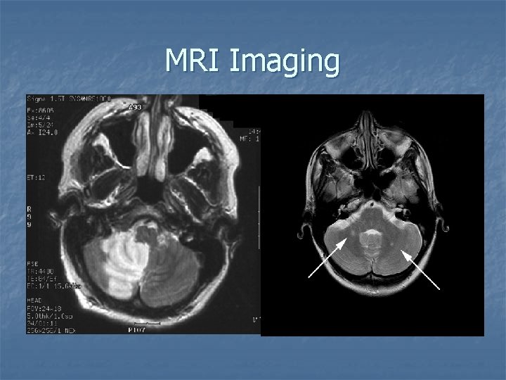 MRI Imaging 