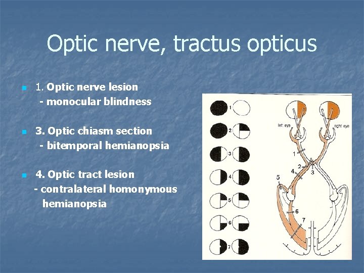 Optic nerve, tractus opticus 1. Optic nerve lesion - monocular blindness n 3. Optic