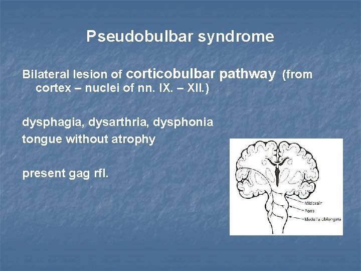 Pseudobulbar syndrome Bilateral lesion of corticobulbar pathway (from cortex – nuclei of nn. IX.