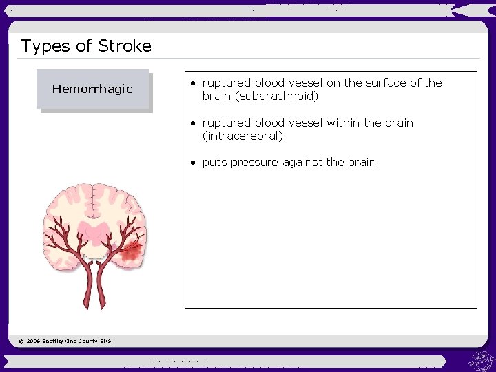 Types of Stroke Hemorrhagic • ruptured blood vessel on the surface of the brain