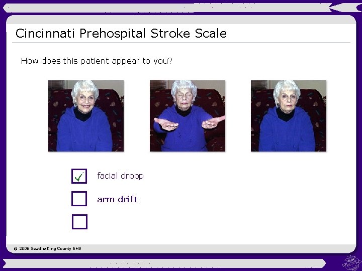 Cincinnati Prehospital Stroke Scale How does this patient appear to you? facial droop arm