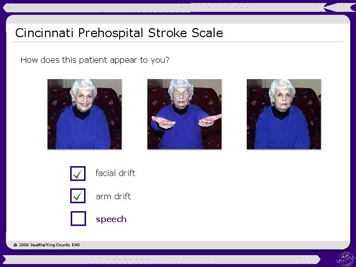 Cincinnati Prehospital Stroke Scale How does this patient appear to you? facial drift arm