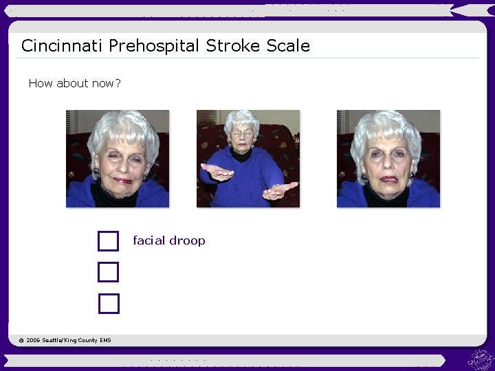 Cincinnati Prehospital Stroke Scale How about now? facial droop © 2006 Seattle/King County EMS