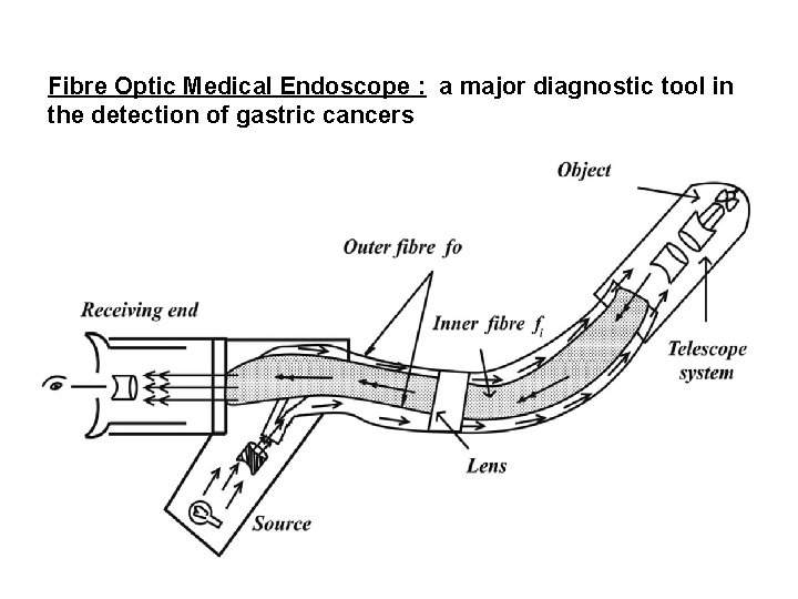 Fibre Optic Medical Endoscope : a major diagnostic tool in the detection of gastric