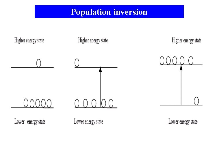 Population inversion 