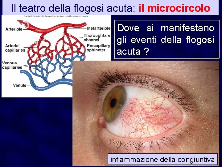 Il teatro della flogosi acuta: il microcircolo Dove si manifestano gli eventi della flogosi