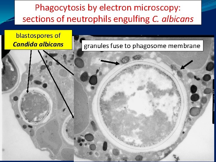 Phagocytosis by electron microscopy: sections of neutrophils engulfing C. albicans blastospores of Candida albicans