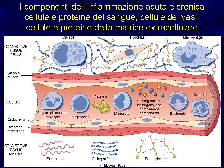 I componenti dell’infiammazione acuta e cronica cellule e proteine del sangue, cellule dei vasi,