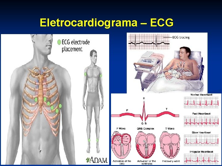 Eletrocardiograma – ECG 