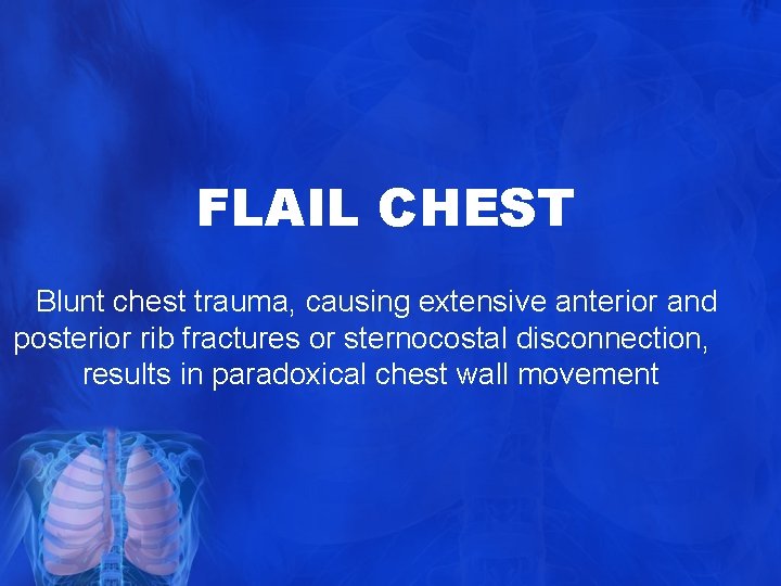 FLAIL CHEST Blunt chest trauma, causing extensive anterior and posterior rib fractures or sternocostal