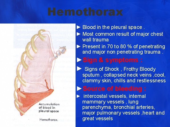 Hemothorax ► Blood in the pleural space. ► Most common result of major chest