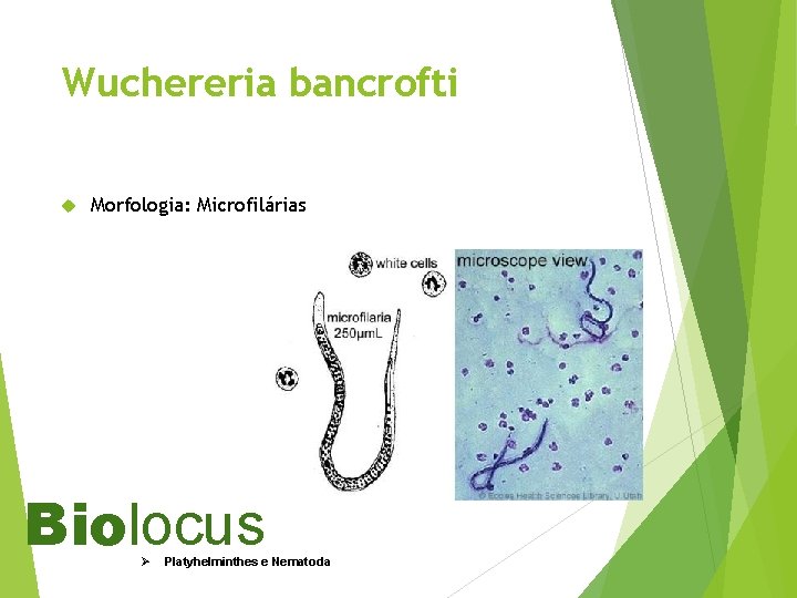 Wuchereria bancrofti Morfologia: Microfilárias Biolocus Ø Platyhelminthes e Nematoda 