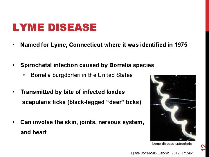 LYME DISEASE • Named for Lyme, Connecticut where it was identified in 1975 •