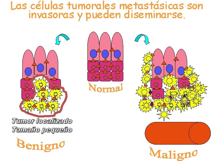 Las células tumorales metastásicas son invasoras y pueden diseminarse. 