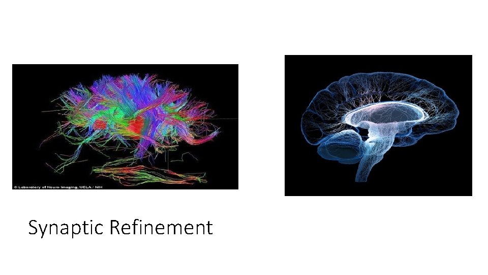 Synaptic Refinement 