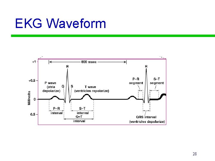 EKG Waveform 28 