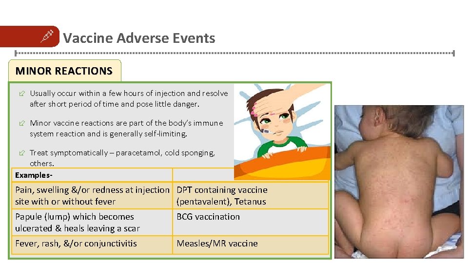 Vaccine Adverse Events MINOR REACTIONS ÷ Usually occur within a few hours of injection