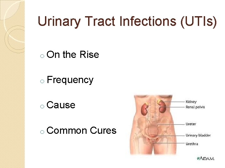 Urinary Tract Infections (UTIs) o On the Rise o Frequency o Cause o Common