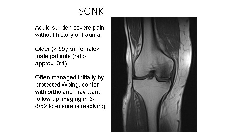 SONK Acute sudden severe pain without history of trauma Older (> 55 yrs), female>