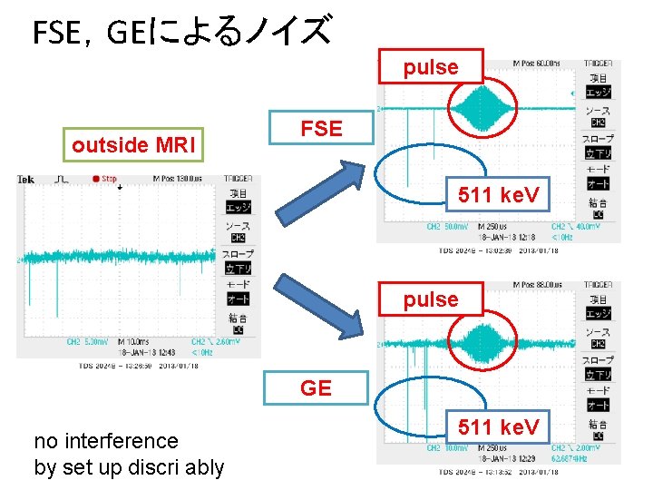 FSE，GEによるノイズ pulse outside MRI FSE 511 ke. V pulse GE no interference by set