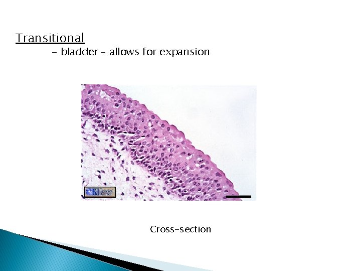Transitional - bladder – allows for expansion Cross-section 
