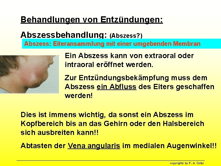 Behandlungen von Entzündungen: Abszessbehandlung: (Abszess? ) Abszess: Eiteransammlung mit einer umgebenden Membran Ein Abszess