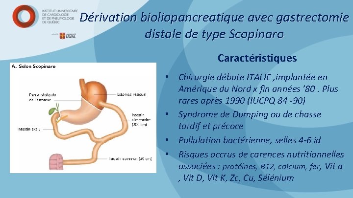 Dérivation bioliopancreatique avec gastrectomie distale de type Scopinaro Caractéristiques • Chirurgie débute ITALIE ,