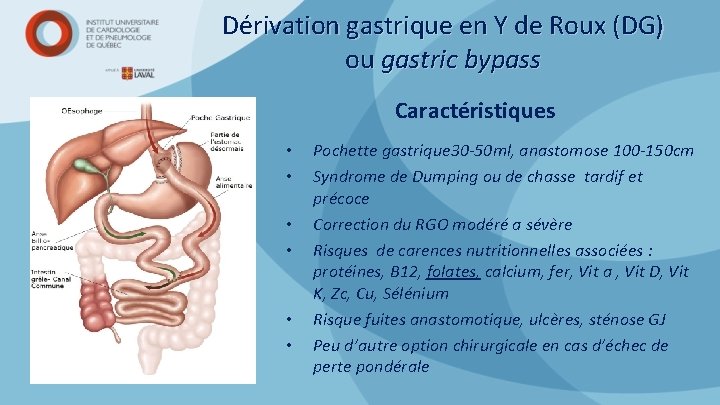 Dérivation gastrique en Y de Roux (DG) ou gastric bypass Caractéristiques • • •