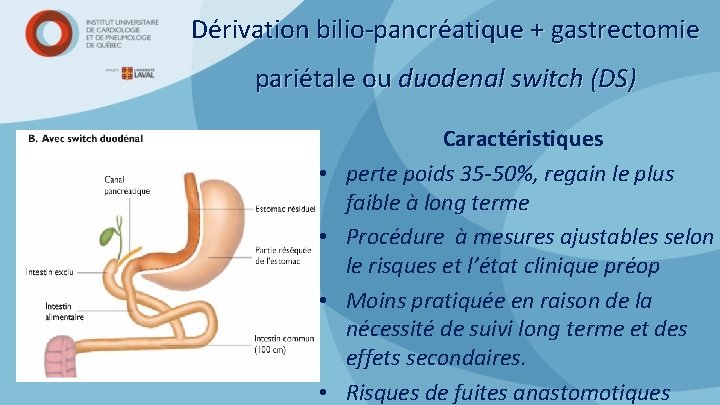 Dérivation bilio-pancréatique + gastrectomie pariétale ou duodenal switch (DS) • • Caractéristiques perte poids