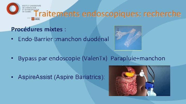 Traitements endoscopiques: recherche Procédures mixtes : • Endo-Barrier : manchon duodénal • Bypass par